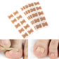 NailFix™ - From ingrown toenails to beautiful and healthy nails (25+25 FREE)